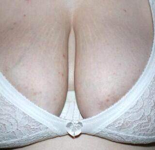 boobolicious70, Tanworth-in-Arden, Warwickshire